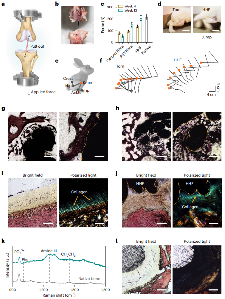 彭慧勝教授，最新Nature Nanotechnology！